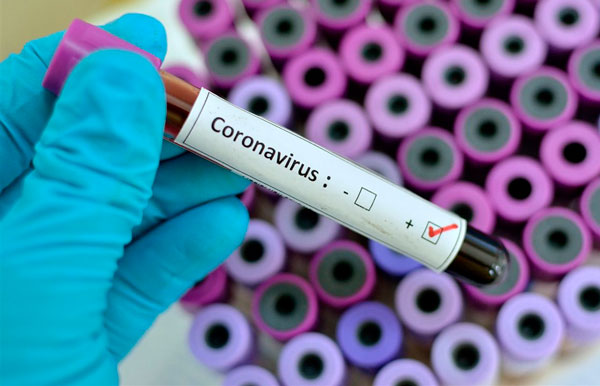 Resultado de imagen de coronavirus positivo